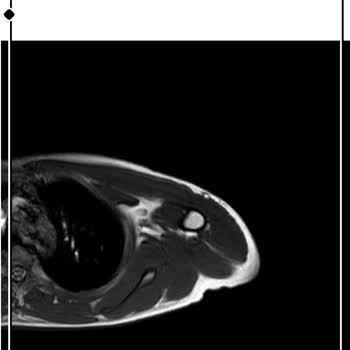 Sultanbeyli Devlet Hastanesi'nde Ortopedi Bölümünün İlgisizliği