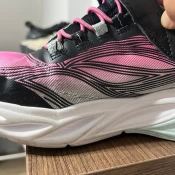 Skechers Ayakkabısının Kısa Sürede Kenar Yırtılması Ve Destek Eksikliği