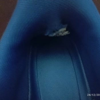 Çocuk Ayakkabısının Hızlı Deformasyonu Ve Kullanıcı Hatası İddiası