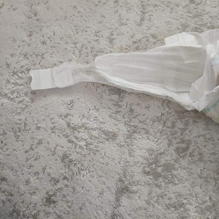 Molfix 6 Numaralı Bebek Bezinde Bant Tutmuyor Ve İç Katman Ayrılıyor