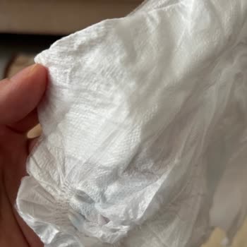 Molfix Bebek Bezinde Yan Bantların İçeride Olması Bebek Güvenliğini Tehdit Ediyor