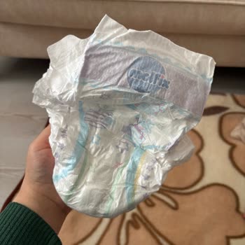 Molfix Bebek Bezinde Yan Bantların İçeride Olması Bebek Güvenliğini Tehdit Ediyor