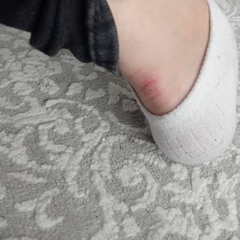 Ayak Yaralayan Botta Üretim Hatası Ve Değişim İsteği