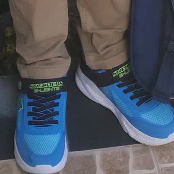 Skechers Ayakkabısında Yoğun Koku Ve Garanti Reddi