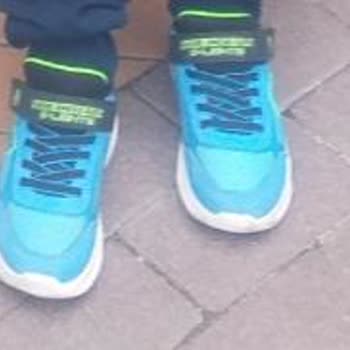 Skechers Ayakkabısında Yoğun Koku Ve Garanti Reddi