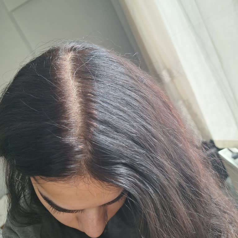 L’Oréal Saç Boyasının Beyazları Kapatmaması Ve Saçları Yıpratması