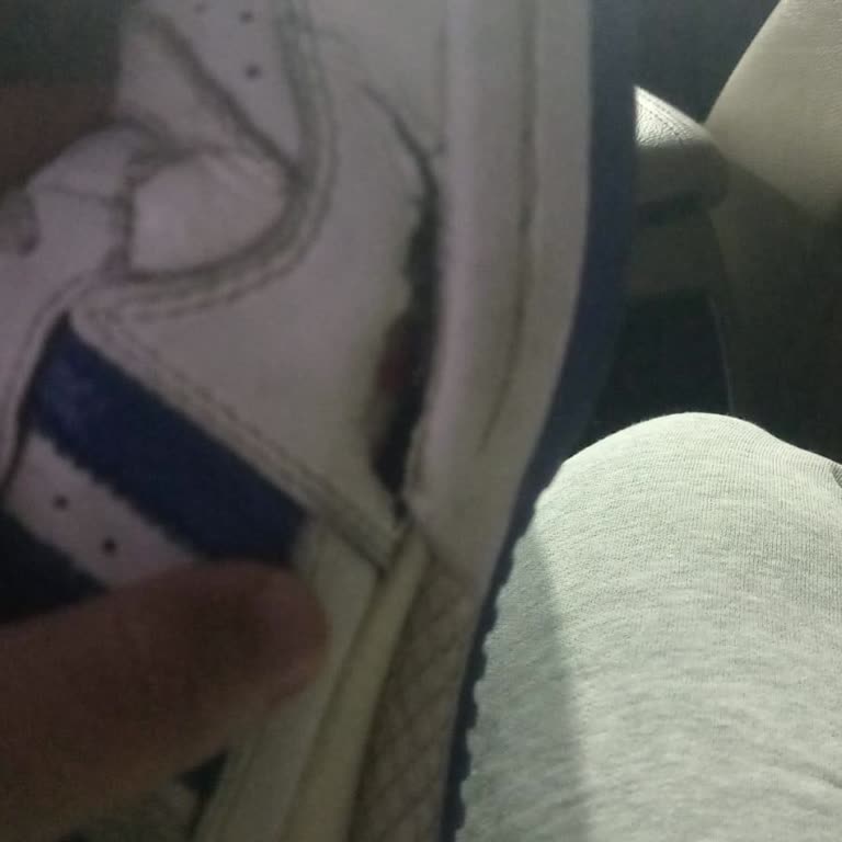 Adidas Ayakkabısında Kısa Sürede Yırtılma Ve Yetersiz Müşteri Açıklaması