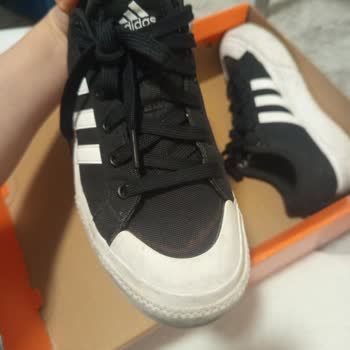 Adidas Ayakkabımda Hızlı Kumaş Deformasyonu Ve Renk Sorunu