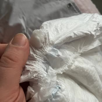 Molfix Maxi Bebek Bezi Yan Bantta Sakızımsı Yapışkan Ve Hijyen Endişesi