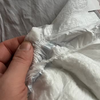 Molfix Maxi Bebek Bezi Yan Bantta Sakızımsı Yapışkan Ve Hijyen Endişesi