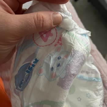 Molfix Maxi Bebek Bezi Yan Bantta Sakızımsı Yapışkan Ve Hijyen Endişesi