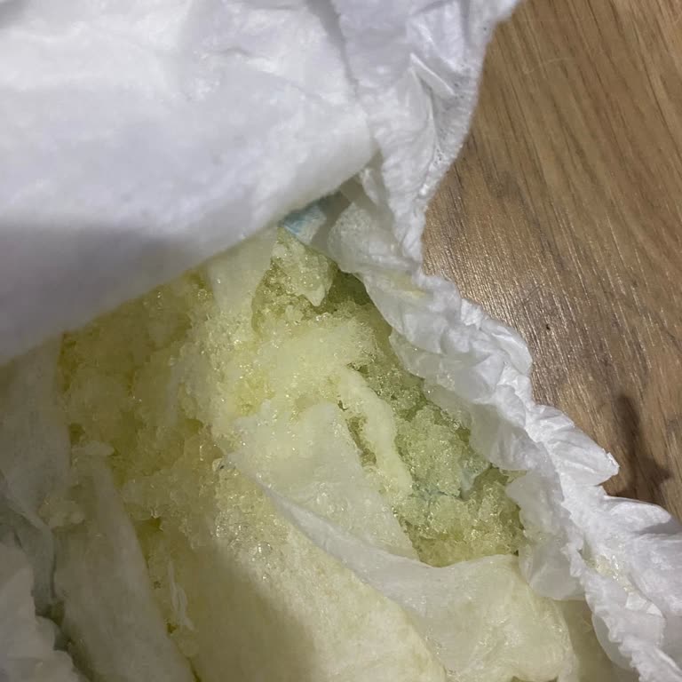 Molfix Bebek Bezinde Kristal Patlaması Cildi Tahriş Etti