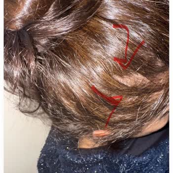 L’Loreal Paris Glycolic Gloss Saç Dökülmesine Neden Oldu