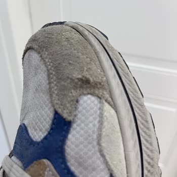 Skechers Ayakkabısında Kalite Sorunu Ve Garanti Sürecinde Kullanıcı Hatası İddiası