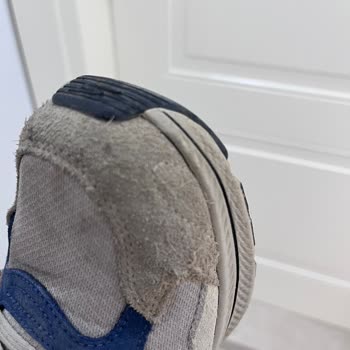 Skechers Ayakkabısında Kalite Sorunu Ve Garanti Sürecinde Kullanıcı Hatası İddiası