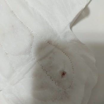 Molped Pedinde Üretim Hatası ve Hijyen Endişesi