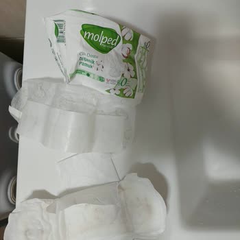 Molped Pedinde Üretim Hatası ve Hijyen Endişesi