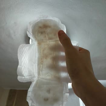 Molped Pedinde Üretim Hatası ve Hijyen Endişesi