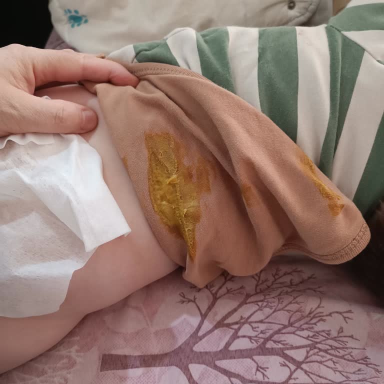 Molfix Bebek Bezinde Sürekli Sızdırma Ve İnce Bant Sorunu