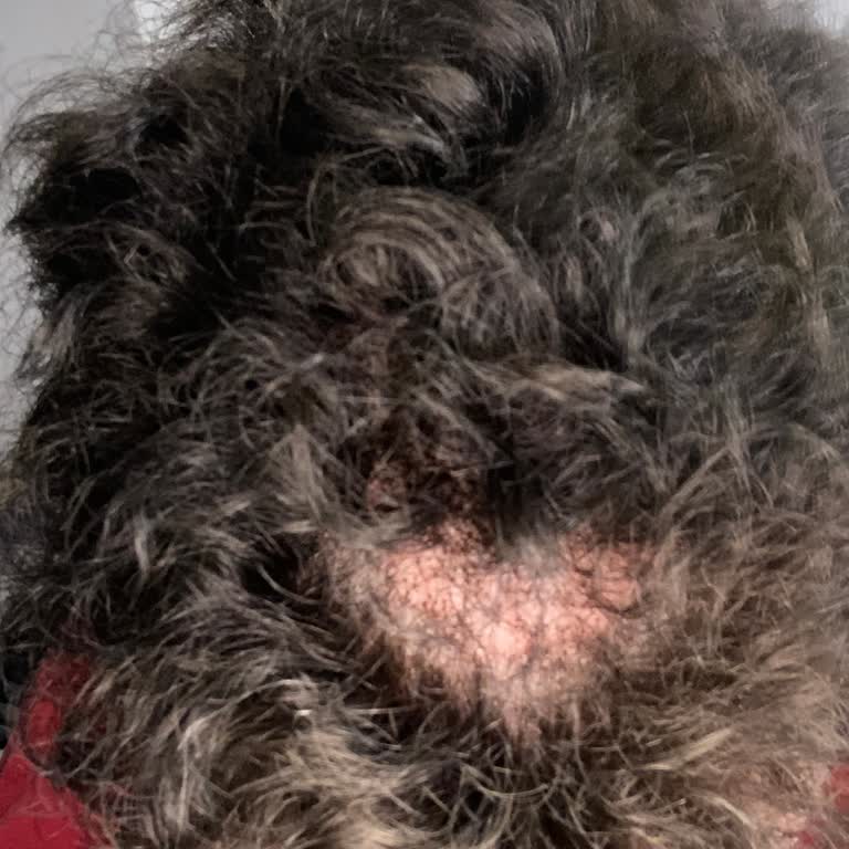 Yanlış Kesim Ve Kalitesiz Protez Saçta 30.000 TL İade Talebi