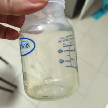 Biberonun Hızlı Sararması Bebeğin Sağlığına Endişe Yaratıyor