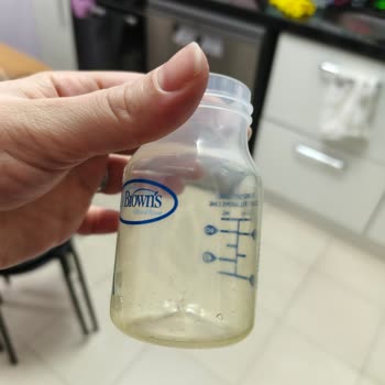 Biberonun Hızlı Sararması Bebeğin Sağlığına Endişe Yaratıyor