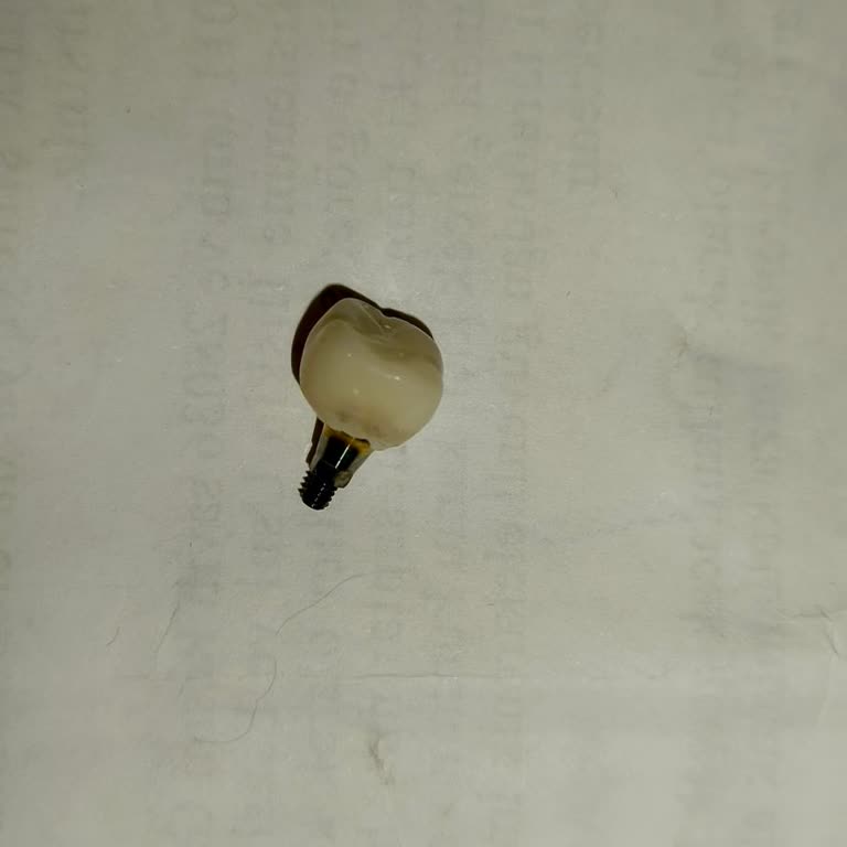 Medical Park Hastanesi Ömür Boyu Garanti Verilen İmplant Sorunu ve Uzayan Tedavi Süreci