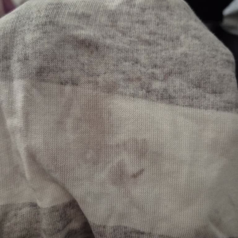 Çocuğumun Üst Giyimde Renk Atlama Ve Güven Kaybı