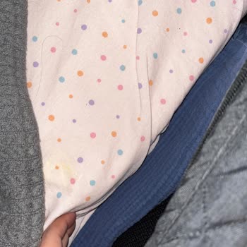 Huggy Anne Yanı Aparatı Kırıldı, Silikon Parçalar Çıkıyor ve Bebek Güvenliği Tehlikede