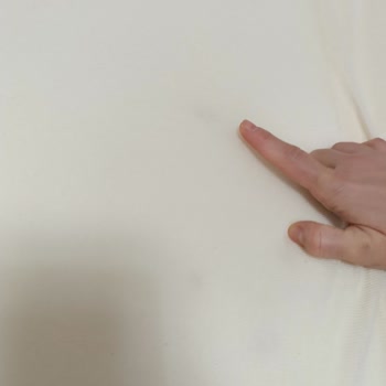 Yataş Misafir Yataklarındaki Küf Lekesi Ve Cevapsız Başvuru