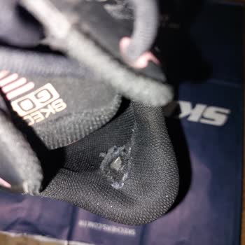 Skechers Ayakkabısındaki Üretim Hatası Nedeniyle Oluşan Yırtık Ve Tahriş Sorunu