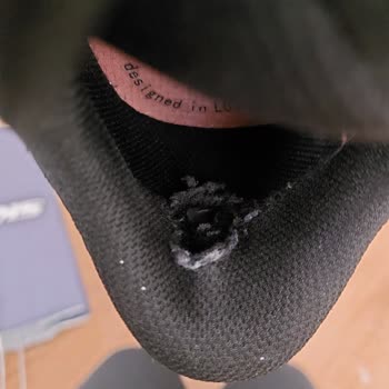 Skechers Ayakkabısındaki Üretim Hatası Nedeniyle Oluşan Yırtık Ve Tahriş Sorunu