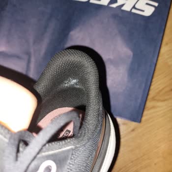 Skechers Ayakkabısındaki Üretim Hatası Nedeniyle Oluşan Yırtık Ve Tahriş Sorunu