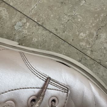 Kısa Sürede Açılan Çocuk Botu Kalitesizliği Ve Geri Ödeme Talebi