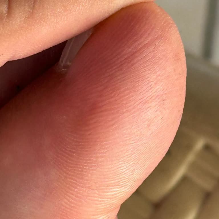 Adidas Terrex Ayakkabısının 7 Gün İçinde Kırılması Ve Müşteri Hizmetinin Umursamaz Tutumu