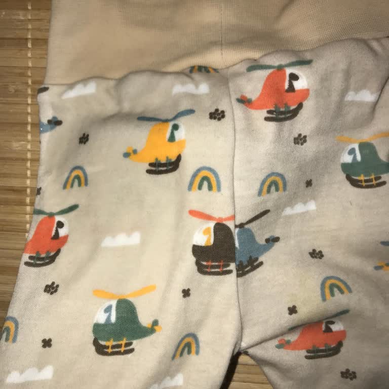 Prima 1 Numaralı Bebek Bezi Sızdırma Sorunu Ve İade Talebi