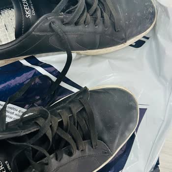 Skechers Ayakkabısında Beş Ayda Aşırı Deformasyon Ve Garanti Reddi