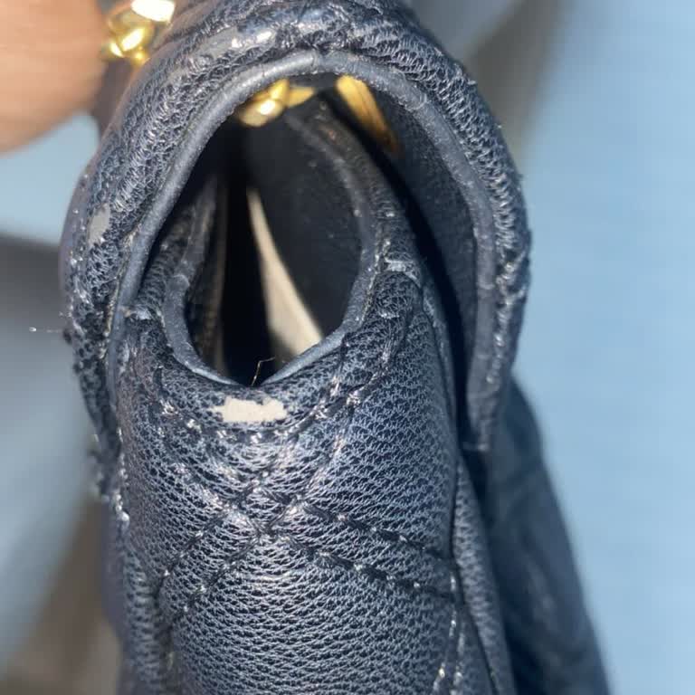 Boyner Çantasındaki Deri Soyulması Ve İade Talebimin Reddedilmesi