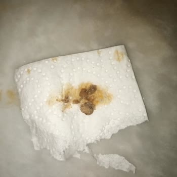 Burcu Barbunya Pilaki Şikayeti