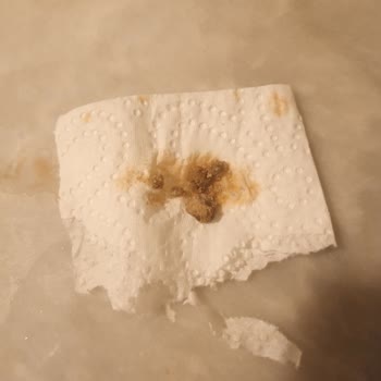 Burcu Barbunya Pilaki Şikayeti