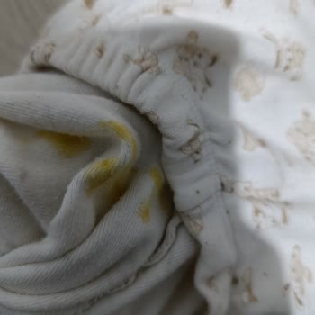 Molfix Premium Bebek Bezinde Orta Kısımdan Sızma Ve İade Talebi