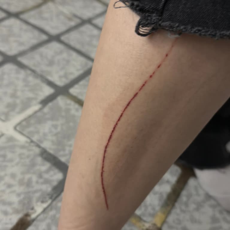 DeFacto Beyazıt Şubesinde Alarm İğnesi Nedeniyle Derin Kesik Ve İlgisizlik