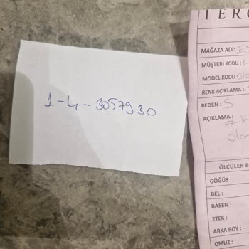 Kısa Sürede Deforme Olan Deri Mont Ve Cevapsız Servis