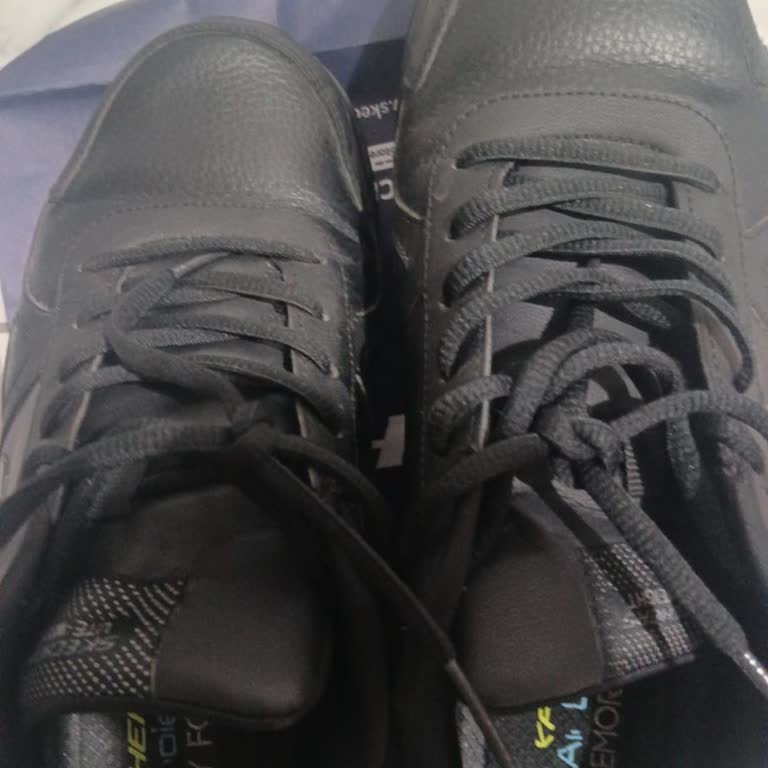 Skechers Ayakkabımda Deformasyon, Mağaza Reddi Ve Değişim Talebi