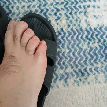 Ayıplı Outdoor Ayakkabı Ve Mağaza İlgisizliği Nedeniyle 7.299 TL İade Talebi