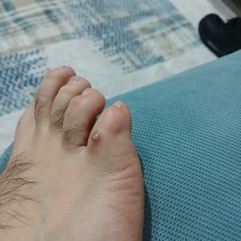 Ayıplı Outdoor Ayakkabı Ve Mağaza İlgisizliği Nedeniyle 7.299 TL İade Talebi