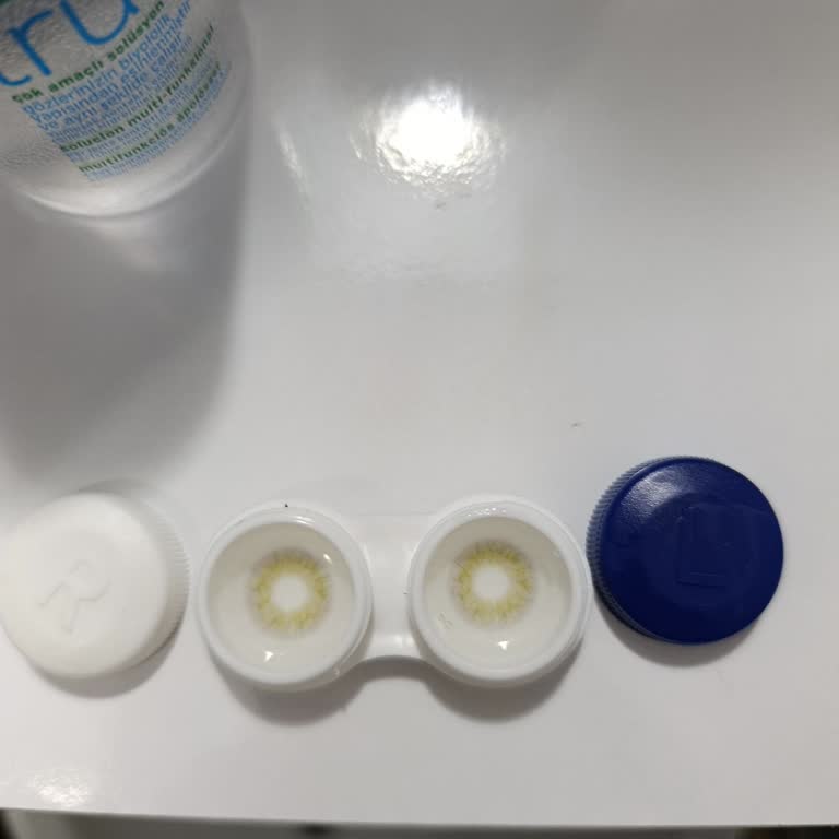 Labella Premium Dream Lensinde Yanma Ve Alerji Nedeniyle Mağduriyet