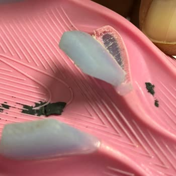 Nike Kramponunda Sol Tek Diş Kırılması Ve Değişim Talebi