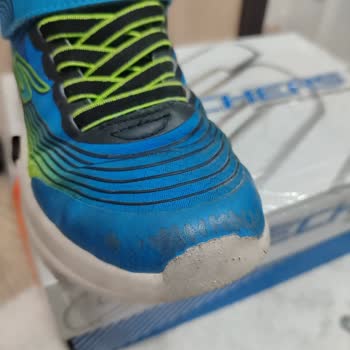 Skechers Çocuk Ayakkabısının Kısa Sürede Deforme Olması Ve Gerekçesiz Ret Kararı