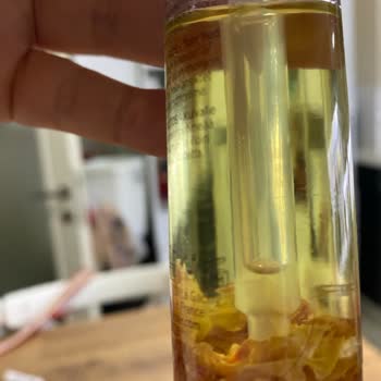 Serumda Kıl Bulunması Hijyen İhlali Ve Ücretsiz Değişim Talebi